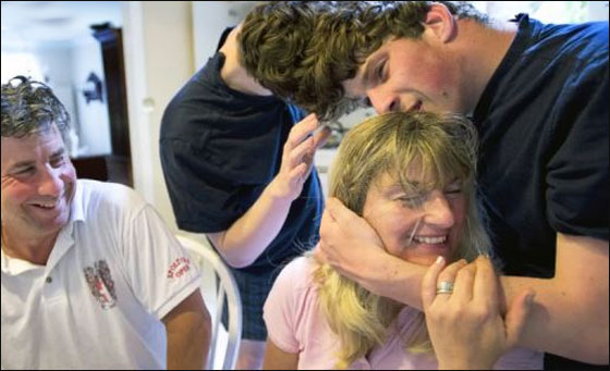 لاول مرة: توامان سياميان لا يريان بعضهما يرويان قصتهما 