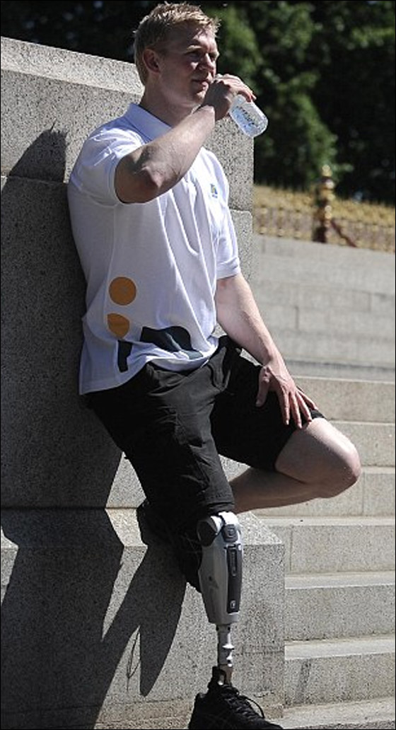 لاول مرة: ساق اصطناعية "مفكرة" تعمل من خلال احاسيس مستخدمها!