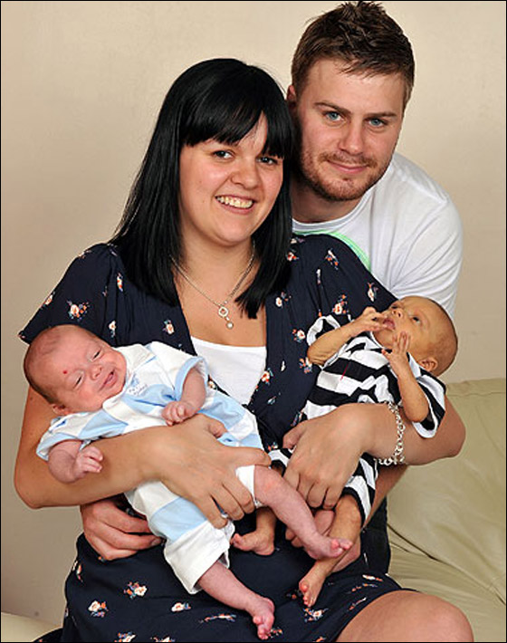 في سابقة هي الاولى من نوعها:  ولادة توأمان بفارق يومين!!