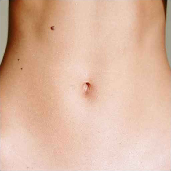 تنوع بكتيري هائل في سرة البطن وصل لـ1400 سلالة بكتيريا!