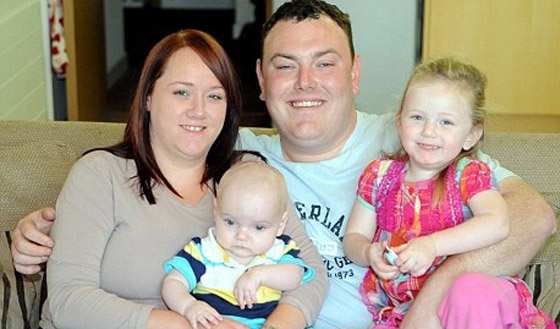 اطباء يحطمون جمجمة رضيع أُصيب بتشوه بارأس لانقاذ حياته!!