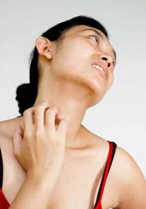 تغلبوا على لسعات الحشرات في الصيف بواسطة العلاجات المنزلية!!