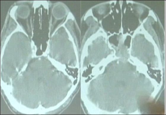 رفض الاستسلام لتوقعات الاطباء بموته.. وشفي من السرطان بالدعاء