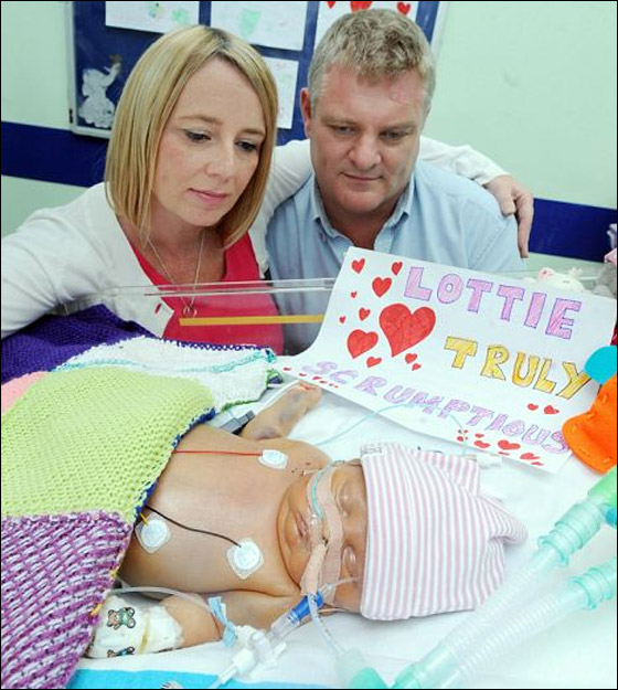 طفلة (4 اشهر) تنتظر وجود متبرع مناسب لاجراء عملية زراعة كبد!!