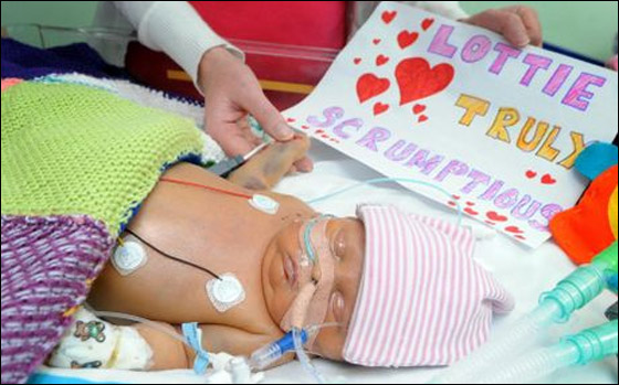 طفلة (4 اشهر) تنتظر وجود متبرع مناسب لاجراء عملية زراعة كبد!!