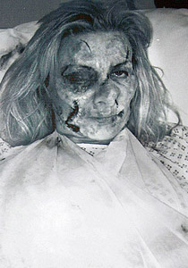 لادمانها على الجمال.. بريطانية تخضع لاكثر من 100 عملية تجميل