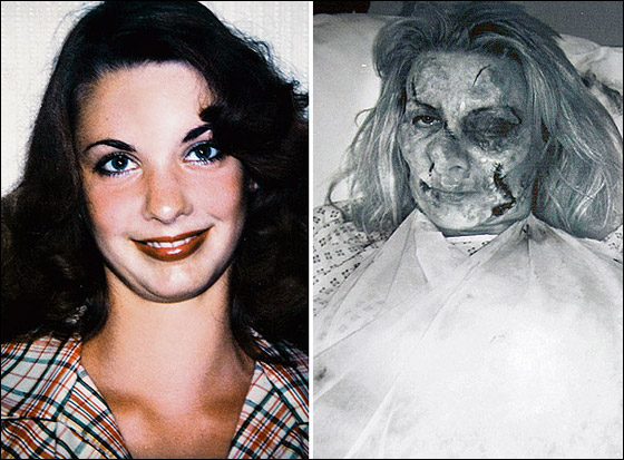 لادمانها على الجمال.. بريطانية تخضع لاكثر من 100 عملية تجميل