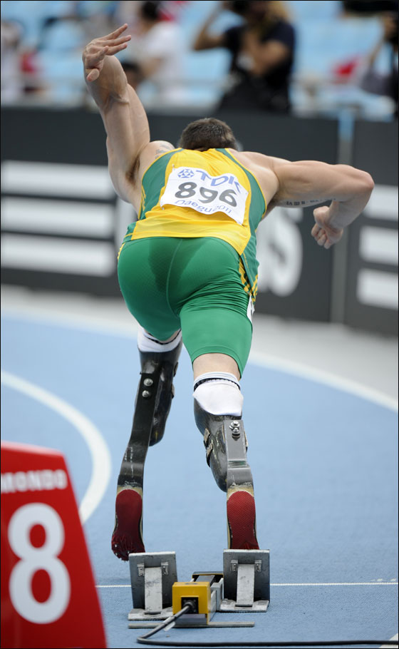 تحدى إعاقته وشارك بسباق الابطال العاديين برجلين حديديتين