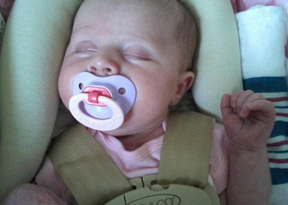 ازالة ورم ضخم من رقبة طفلة يفوق حجم رأسها بنجاح!