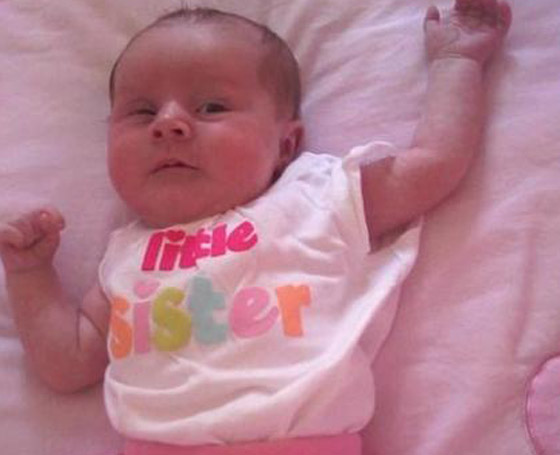 ازالة ورم ضخم من رقبة طفلة يفوق حجم رأسها بنجاح!