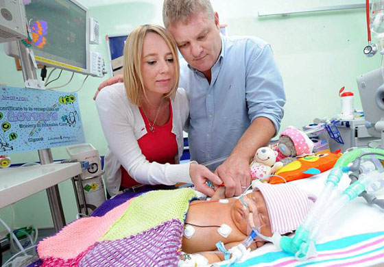 نجاة أصغر طفلة بعد ان خضعت لعملية معقدة لزرع الكبد!