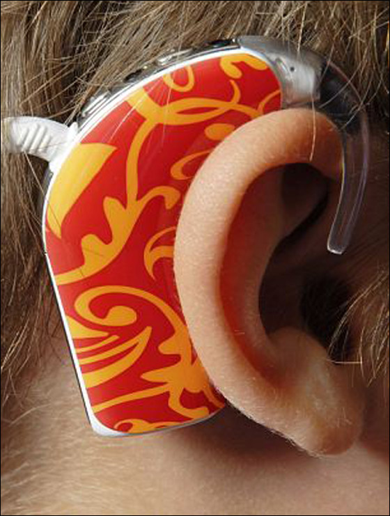 معجزة: طفل يستعيد حاسة السمع بعد مرور 5 اعوام على فقدانها!!