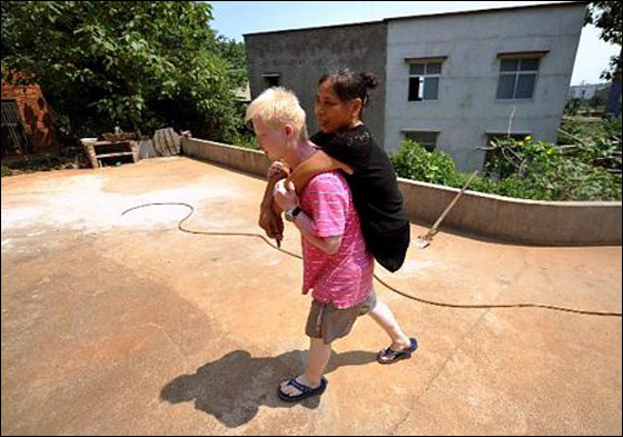 صينية فقدت ساقيها وأبويها تربي أكثر من 130 يتيماً!! 