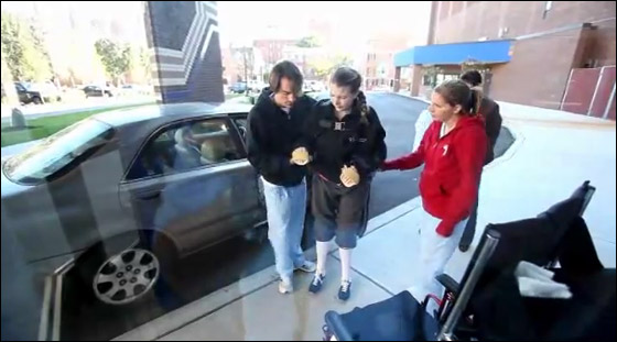 بالفيديو.. نجاح عملية زرع يدين لامرأة في الـ28 من العمر