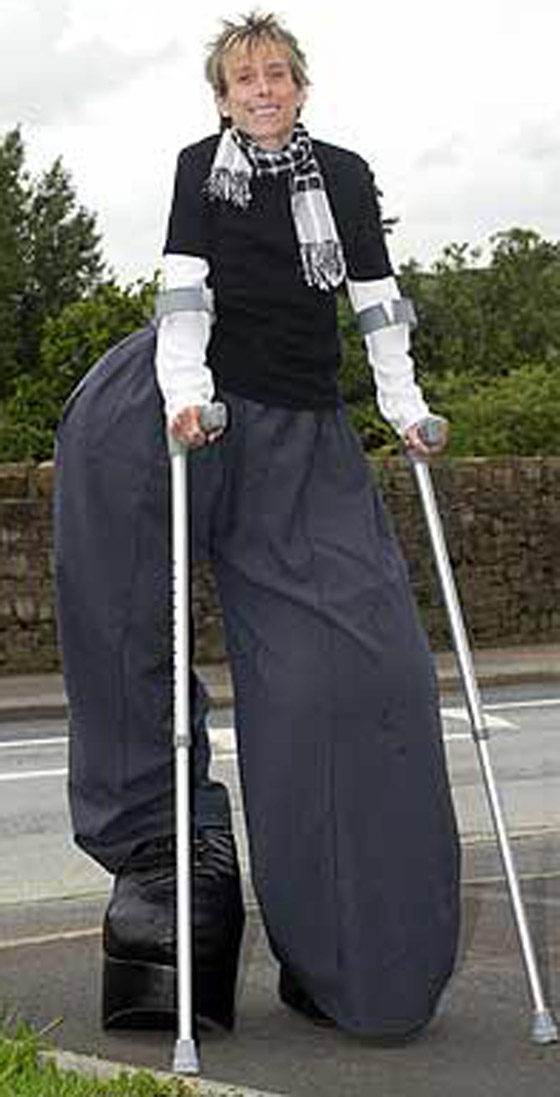 بعد بتر ساقها المتضخمة.. عادت لتنمو وتتضخم من جديد!