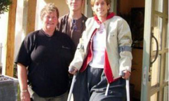 بعد بتر ساقها المتضخمة.. عادت لتنمو وتتضخم من جديد!