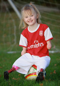 طفلة مبتورة الارجل والايدي تنضم لفريق كرة القدم بمدرستها!! 