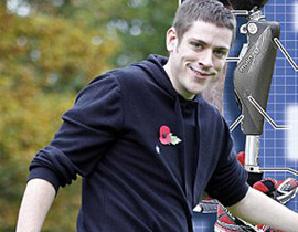 بريطاني يستعيد حياته بحصوله على ساق إلكترونية متطورة!