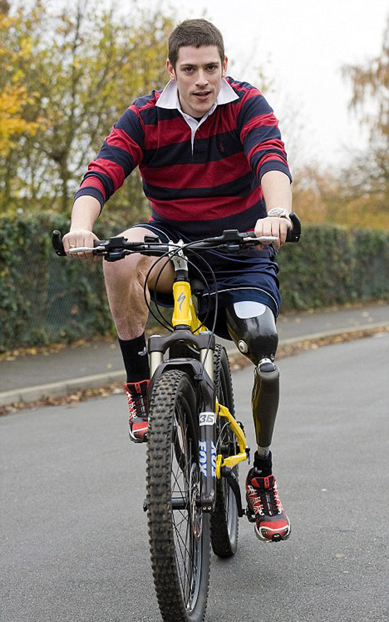 بريطاني يستعيد حياته بحصوله على ساق إلكترونية متطورة!