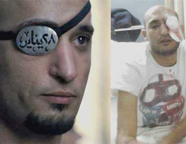 كفيف الثورة يفقد عينه اليمنى بـ 28 يناير واليسرى بـ 19 نوفمبر!