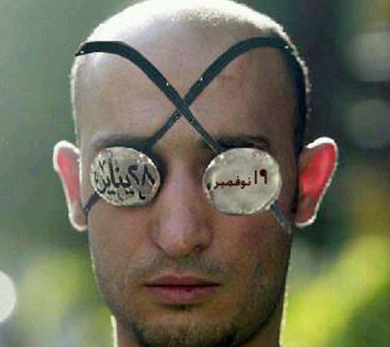 كفيف الثورة يفقد عينه اليمنى بـ 28 يناير واليسرى بـ 19 نوفمبر!