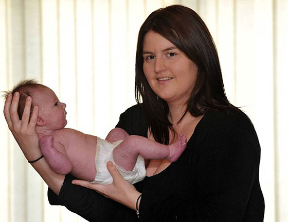 معجزة طفل بعد ولادته بـ22 ساعة خضع لعملية قلب مفتوح!