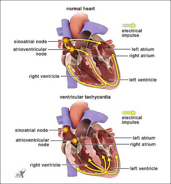 برادلي طفل السابعة ممنوع من الضحك!