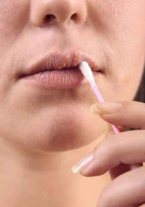 جينات مسؤولة تسبب الحمو لدى الانسان!