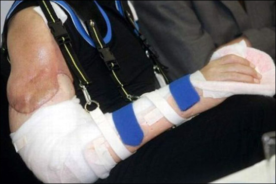 بالصور.. ابرز المعجزات الطبية لعام 2011 حول العالم!