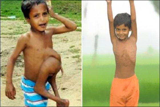 بالصور.. ابرز المعجزات الطبية لعام 2011 حول العالم!