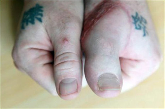 بالصور.. ابرز المعجزات الطبية لعام 2011 حول العالم!