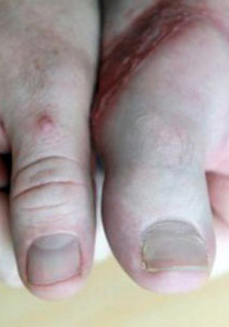 بالصور.. ابرز المعجزات الطبية لعام 2011 حول العالم!