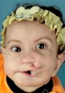 بالصور.. ابرز المعجزات الطبية لعام 2011 حول العالم!