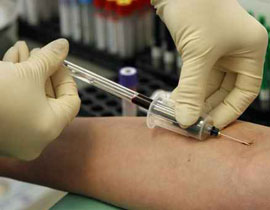 فحص دم يكشف عن الاصابة بازمة قلبية خلال ساعات قليلة!