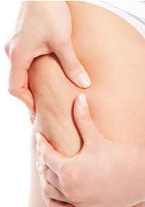 بعض السبل والنصائح للحد من مشكلة السيلوليت!!