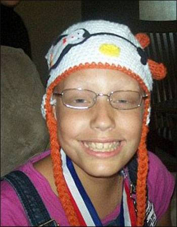 باربي صلعاء وجميلة.. حملة لدعم الاطفال المصابات بالسرطان!!