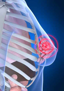 شرح وافي عن انواع التهابات الثدي وكيفية علاجها