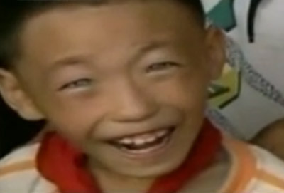 بالفيديو: الطفل القط يتمتع بالقدرة على الرؤية بالظلام ويحير الاطباء