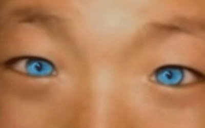 بالفيديو: الطفل القط يتمتع بالقدرة على الرؤية بالظلام ويحير الاطباء