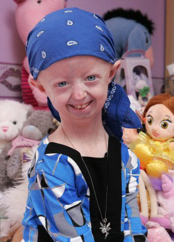 بالصور.. فتاة بعمر 14 عالقة بجسد عجوز تحقق الشهرة!