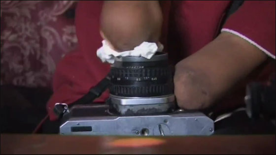 اصرارها على العمل جعلها تحترف التصوير رغم ذراعاها المبتورتين!