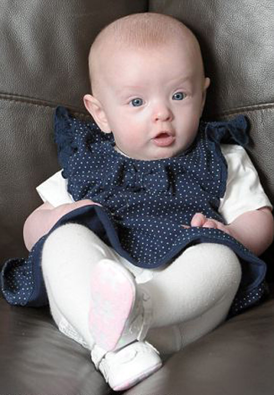 حالة طبية استثنائية.. طفلة تولد بدون دم وتنجو باعجوبة!