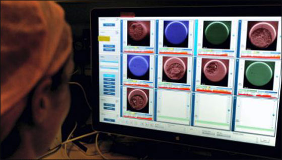 زوجان يشاهدان بالفيديو عملية تخصيب التي انجبت طفلتهما! 