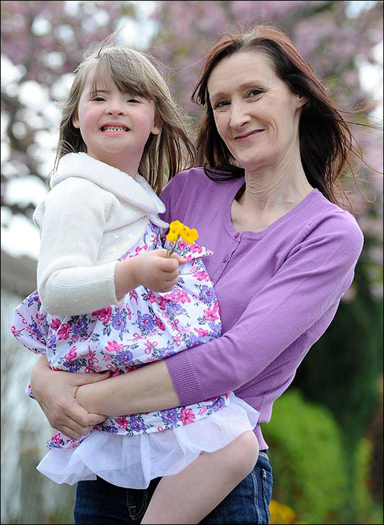 طفلة تعاني من متلازمة "داون" تتبرع بشعرها لمرضى السرطان!!