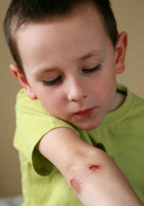 "بيكو".. مكنسة كهربائية تنظف الجروح وتسرّع علاجها!!