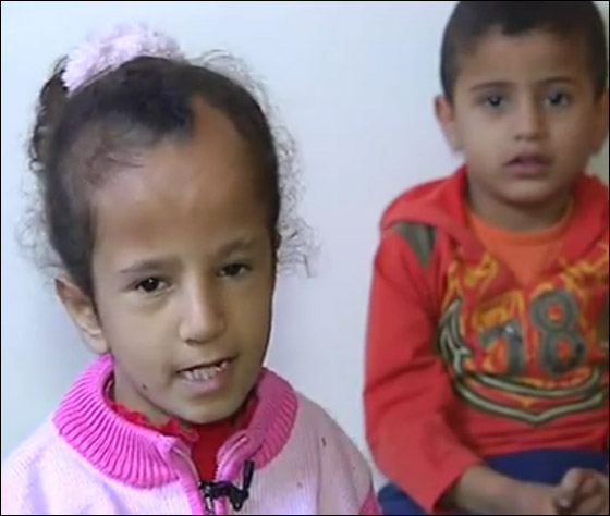 الطفلة بسملة عمرها 9 اعوام تقهر العجز الذي الم باطرافها!