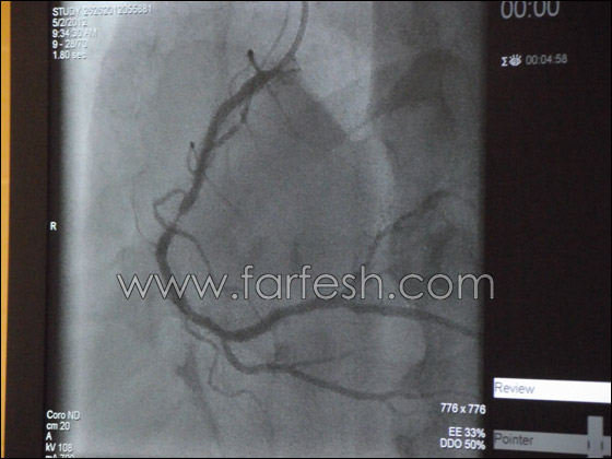 د. خالد سليمان يقتحم قلوب الناس من خلال اليد والفخذ!! 
