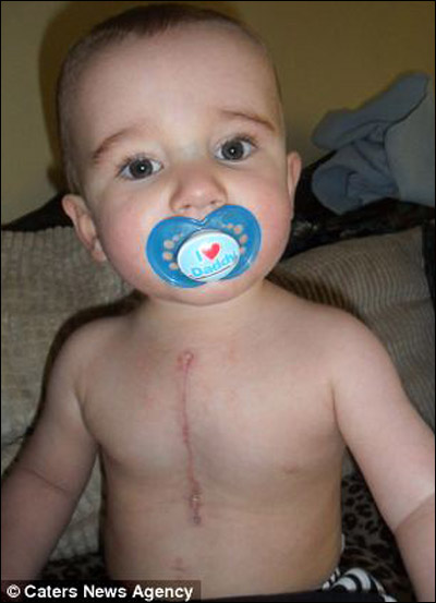 معجزة: نجاة طفل ولد مع 6 قلوب منفصلة رغم التشخيص السلبي!!