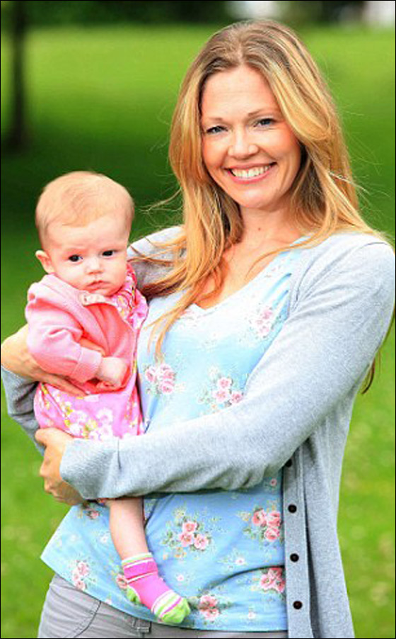 "وحمة" تتحول الى ورم سرطاني عملاق في وجه طفلة تبلغ 4 اشهر!!