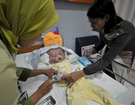 طفلة تحتاج لمعجزة طبية لتتخلص من مرض جعلها كمخلوقات الفضاء